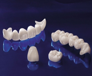 QUI TRÌNH LÀM RĂNG TOÀN SỨ CAD/CAM Zirconia (Emax ZirCAD, Cercon)