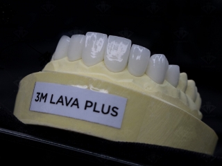 Phục Hình Răng sứ Lava Plus