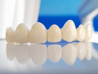 PHỤC HÌNH SỨ ZIRCONIA