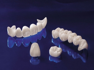 QUI TRÌNH LÀM RĂNG TOÀN SỨ CAD/CAM Zirconia (Emax ZirCAD, Cercon)